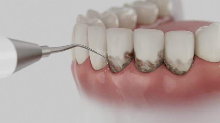 Trusted Tooth Extraction service in Elida, OH - Dentist Open Now
